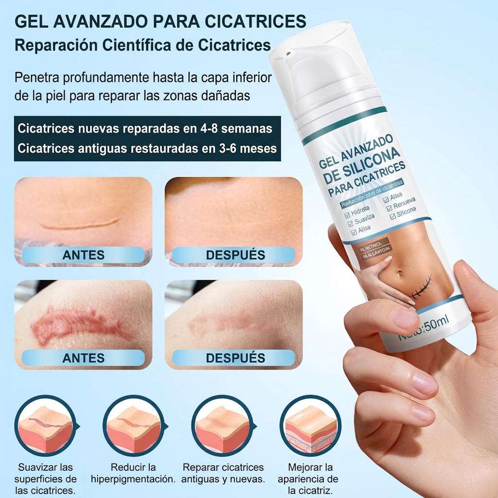 advance-silicone